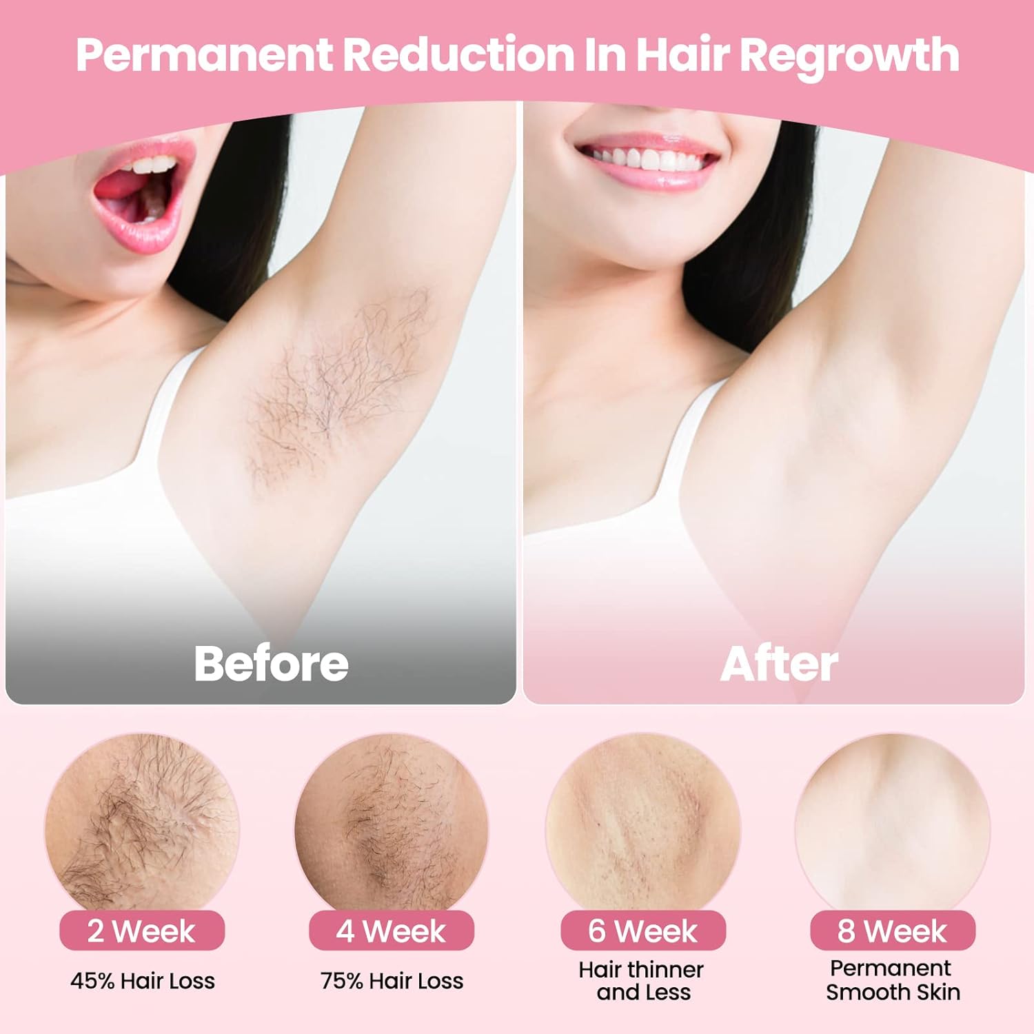 Women's laser epilator, permanent, 999,999 flashes, painless IPL epilator, underarms, legs, arms, bikini line