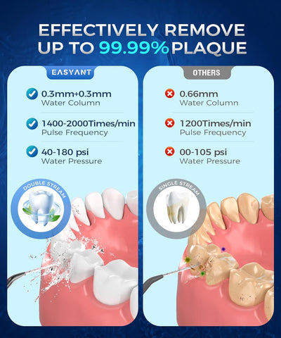 Rechargeable Water Flosser with U-Shaped Tip for Home & Travel