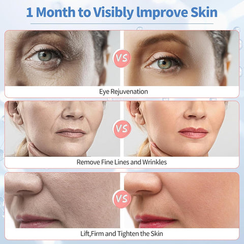 Texet Skin Tightening Device 6-in-1 Microcurrent Facial Device Face Massager, Firming,Lifting, Toning, Wrinkle